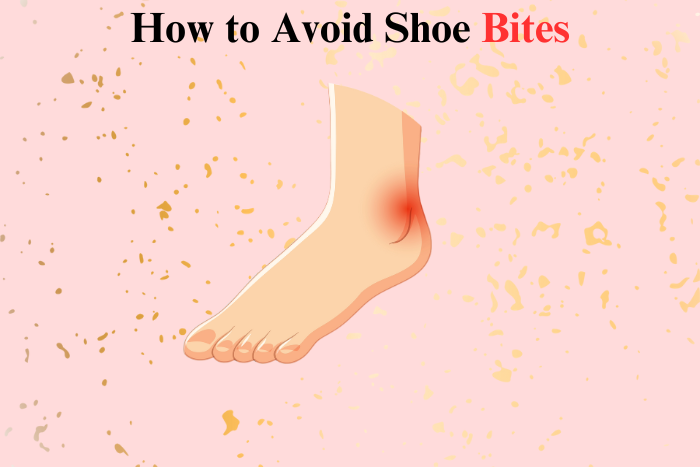 how to avoid shoe bites